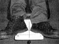 atlas orthogonal alignment after